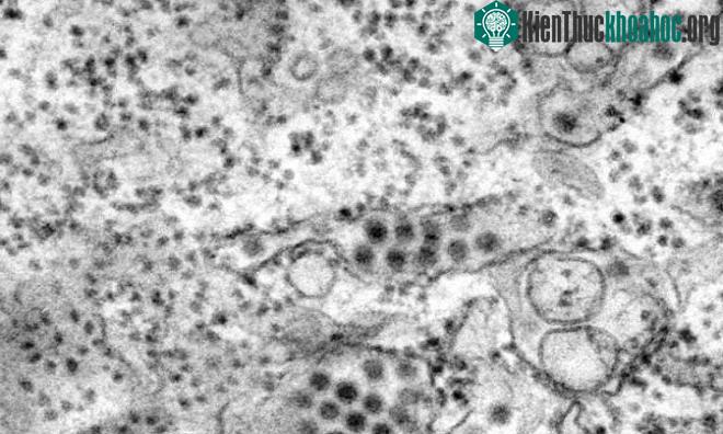 Virus sốt xuất huyết