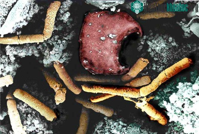 Tác nhân gây bệnh chủ yếu là do tụ cầu vàng (Staphylococcus aureus).