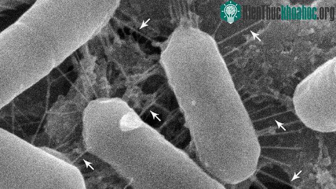 Hình ảnh kính hiển vi quét chủng Lacticaseibacillus casei AMBR2 từ mũi cho thấy những fimbriae dài, hình dạng giống như gai, cho phép vi khuẩn bám vào bề mặt tế bào trong mũi. (Ảnh: Cell Reports).