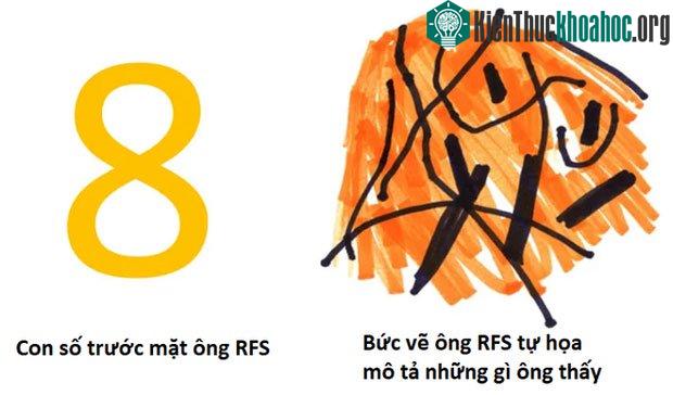 Hội chứng rối loạn thoái hóa não bộ