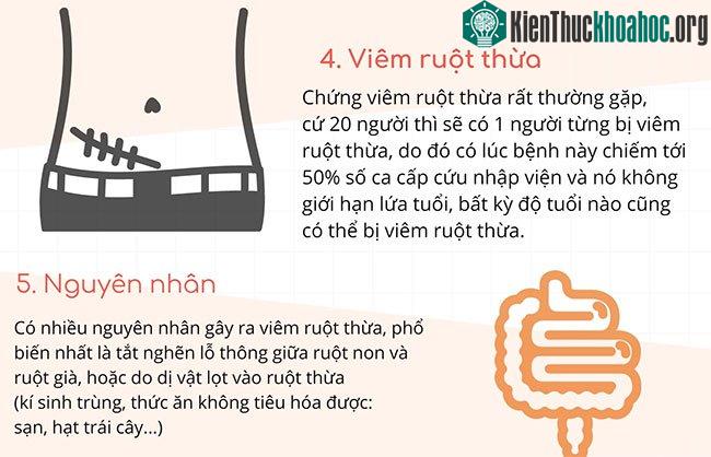 Ruột thừa có lợi hay hại? Triệu chứng và cách xử lý khi bị viêm ruột thừa ảnh 1