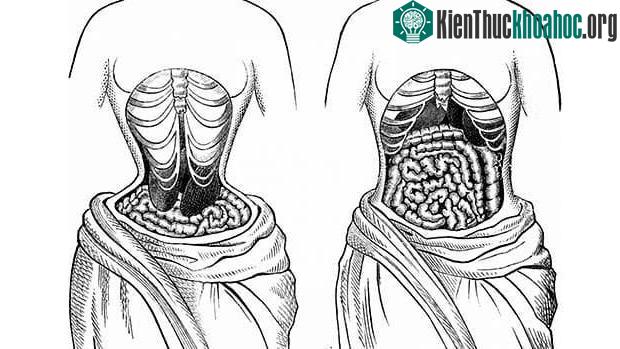 Việc chị em ép mình chịu đựng áp lực từ đai nịt bụng sẽ gây tác động xấu đến dạ dày.