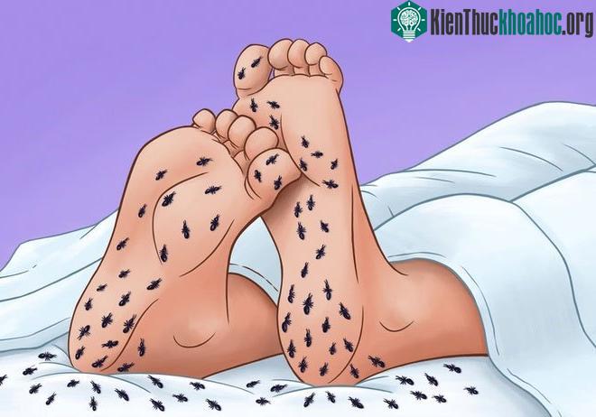 Cảm giác kiến bò ở chân