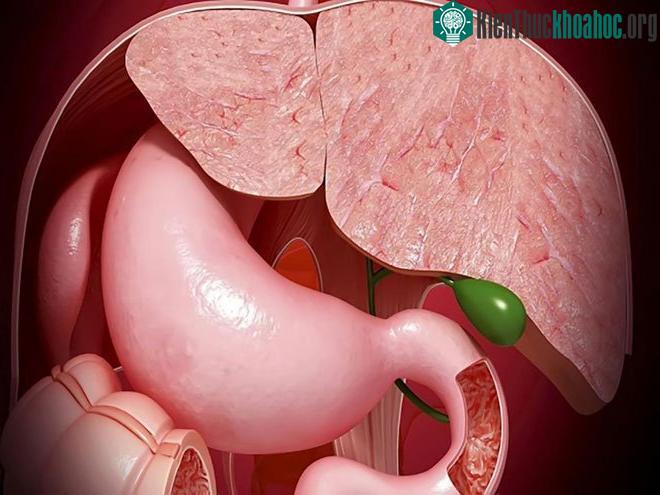Polyp túi mật