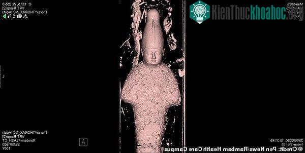 Ảnh chụp CT xác ướp đã làm các chuyên gia bất ngờ