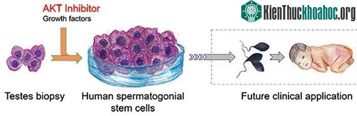 Phương pháp AKT inhibition