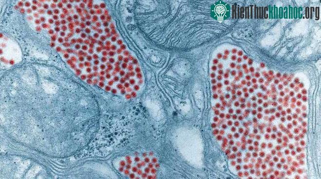 Hình ảnh trên kính hiển vi này cho thấy tuyến nước bọt của muỗi bị nhiễm virus EEE (màu đỏ).