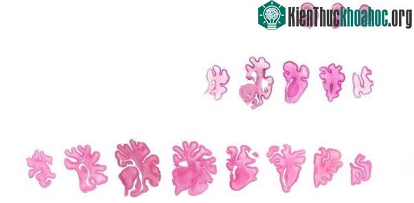 Nếp nhăn trên não hình thành như thế nào? ảnh 0