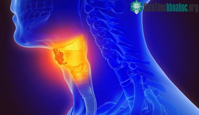 Phương pháp này hứa hẹn sẽ mang tới cách tầm soát ung thư sớm và tiết kiệm chi phí.