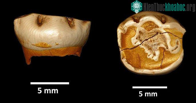 Một trong những chiếc răng sữa Neanderthals