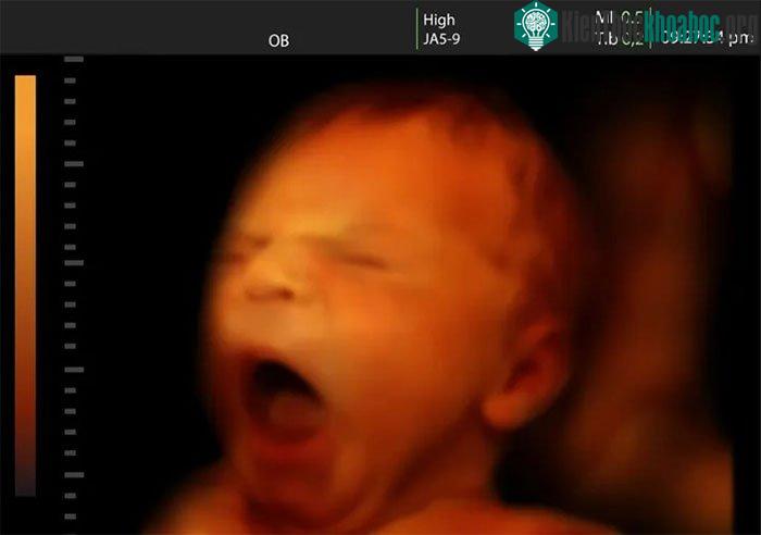 Trẻ sơ sinh không có nhịp sinh học cố định.