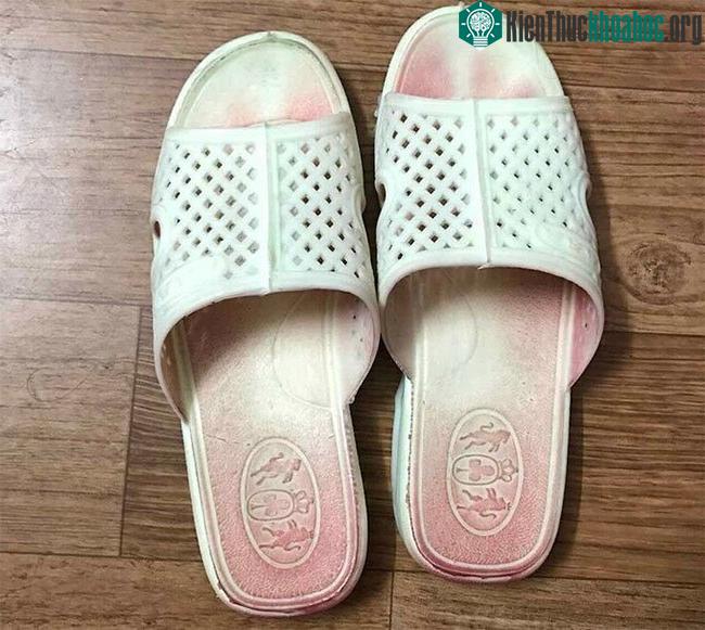 Hiện tượng "mồ hôi máu" lần đầu phát hiện tại Việt Nam ảnh 1