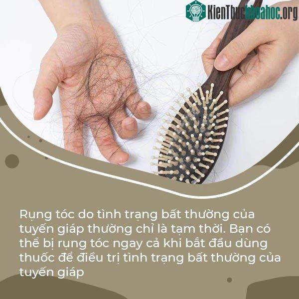 Rụng tóc do tình trạng bất thường của tuyến giáp thường chỉ là tạm thời