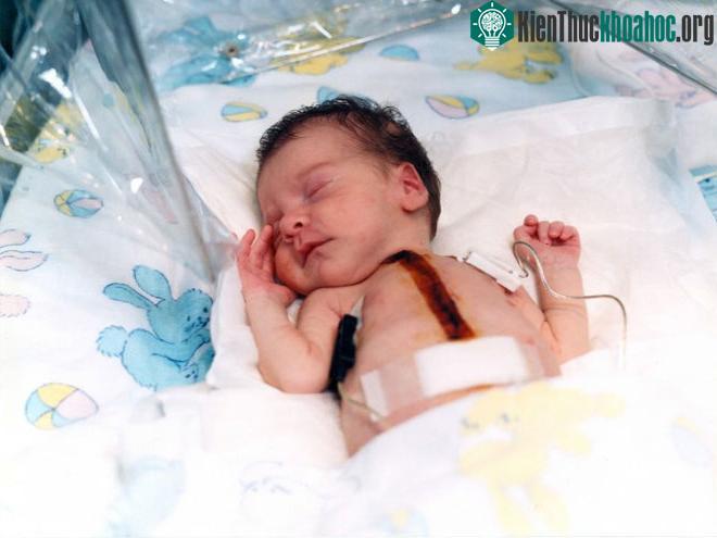 Bé gái hơn 10 ngày tuổi đã mang trong cơ thể trái tim của khỉ sau ca phẫu thuật cấy ghép phi thường ảnh 2