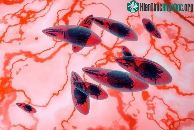Toxoplasma gondii là ký sinh trùng đơn bào có thể gây bệnh nguy hiểm cho người nhiễm