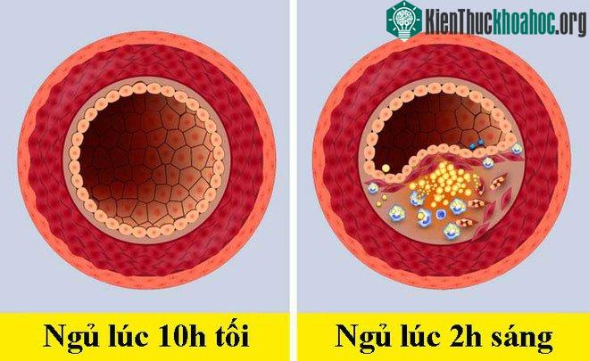 Giảm nguy cơ bệnh tật