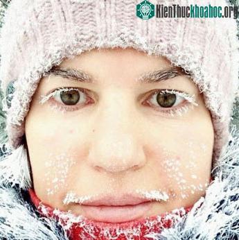Lông mi, lông mày hay môi bị đóng băng của người Siberia