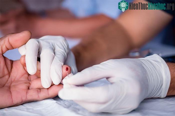 Cách duy nhất để xác định một người có nhiễm HIV hay không là xét nghiệm máu.