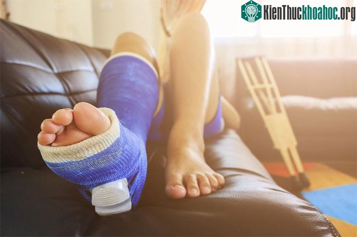 Bệnh nhân gãy xương chày, mác phải mất ít nhất 4-6 tháng để vết thương lành lại
