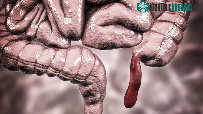 Ruột thừa có nồng độ bạch huyết trong mô cao.