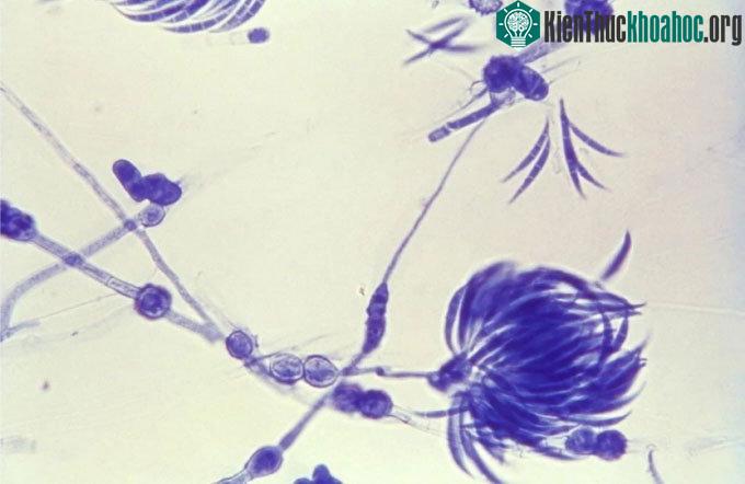 Những phát hiện thú vị về thế giới loài nấm ảnh 1
