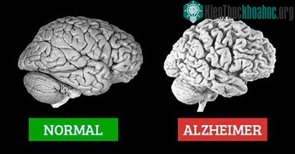 Các tế bào não phục hồi chức năng DNA của chúng như thế nào khi bị già hóa? ảnh 1