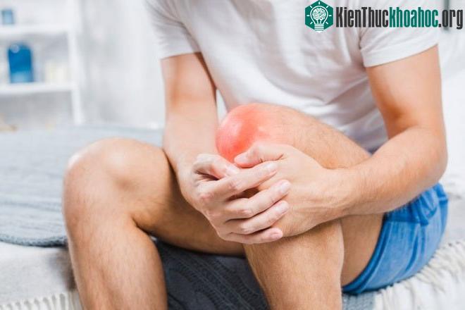 Viêm khớp là một trong những nguyên nhân khiến bạn bị đau nhức chân khi thức dậy.
