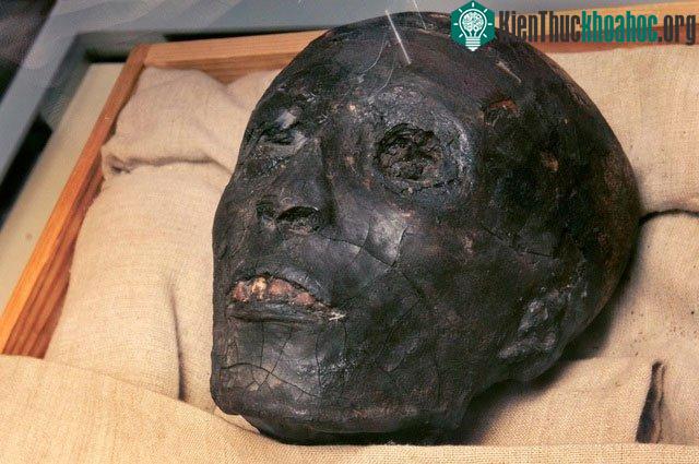 Xác ướp vua Tutankhamun.