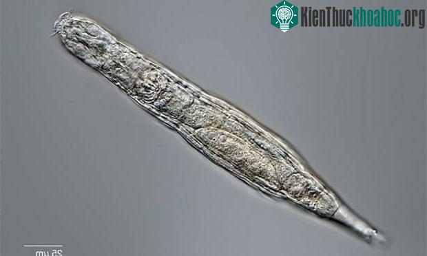 Hình ảnh một con luân trùng dưới kính hiển vi.