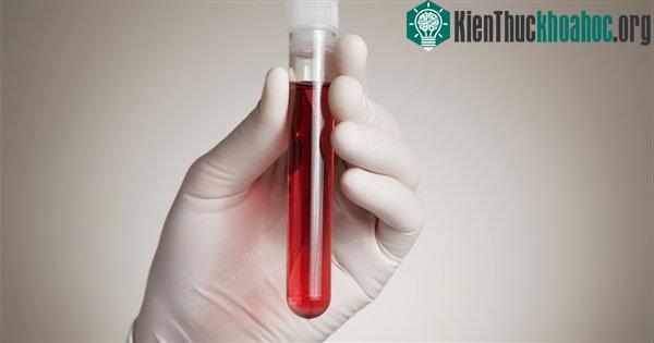 Thiết bị này có thể phát hiện nhiều loại ung thư với độ chính xác hơn 90%.