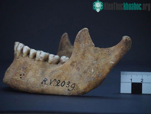 Xương chứa chủng vi khuẩn Yersinia pestis lâu đời nhất được biết đến.