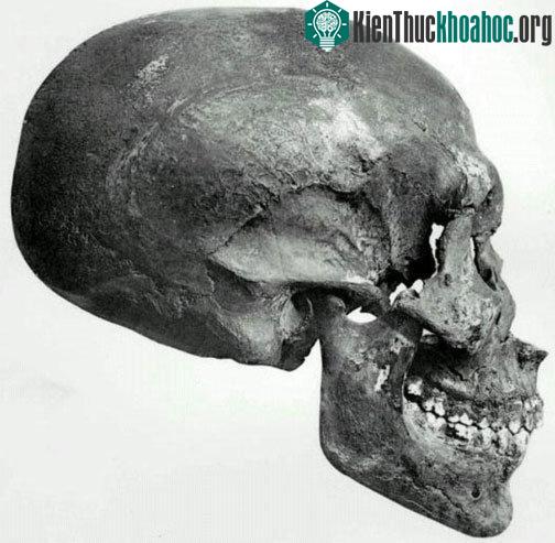 Ảnh hộp sọ của xác ướp.