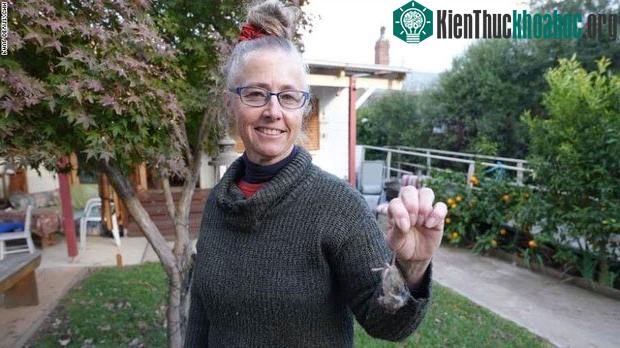 Chuyên gia diệt chuột Sue Hodge