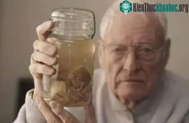 Harvey năm 1994 cầm một chiếc lọ thủy tinh chứa mô não của Einstein