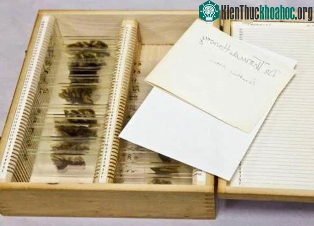 46 lát cắt não của giáo sư Einstein