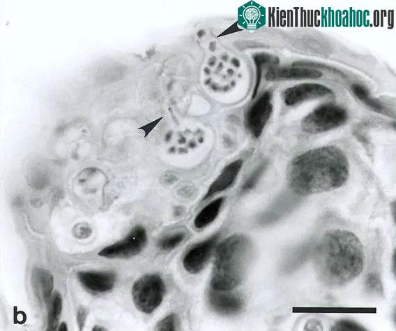 Khả năng gây tử vong của nấm chytrid đối với động vật lưỡng cư là rất lớn.