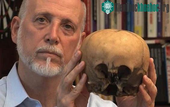 loyd Pye (1946 - 2013) với hộp sọ "Starchild".