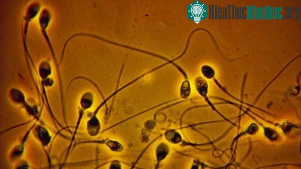 Số lượng tinh trùng của nam giới đã giảm đi một nửa