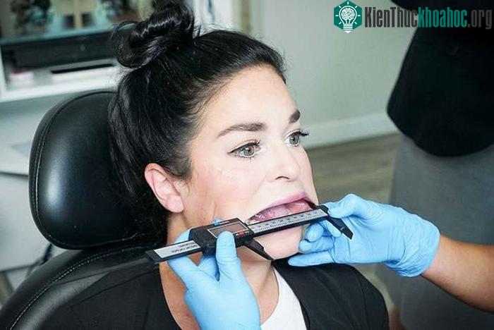 Đo chiều dài và chiều rộng miệng của Samantha Ramsdell.