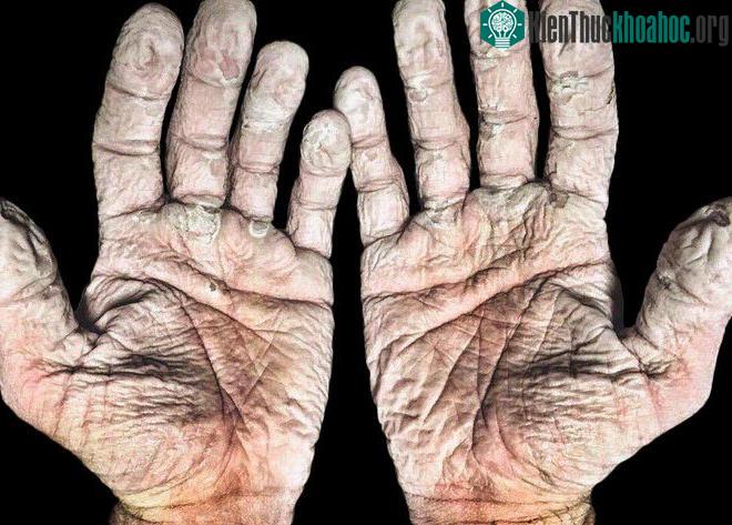 Đôi tay của một vận động viên chèo thuyền