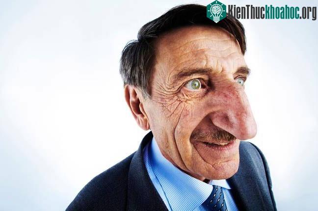 Mehmet Özyürek, 71 tuổi, hiện đang sống tại Thổ Nhĩ Kỳ.