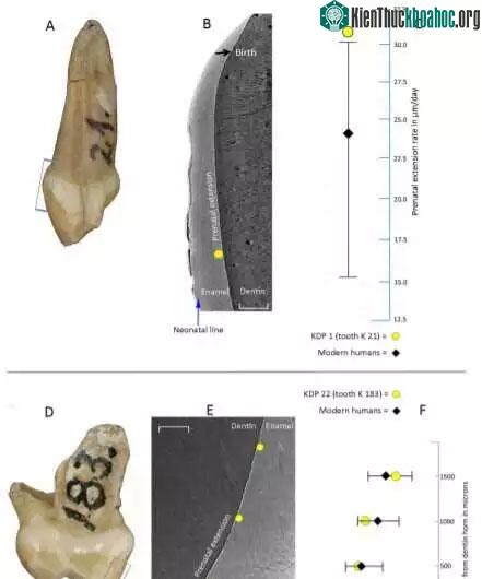 Các mẩu răng cửa của đứa trẻ Neanderthals