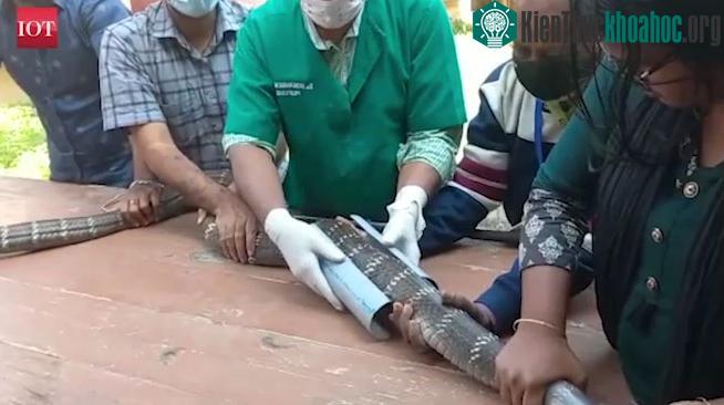 Các bác sĩ bó bột để cố định xương ở các vị trí bị ảnh hưởng.&nbsp;