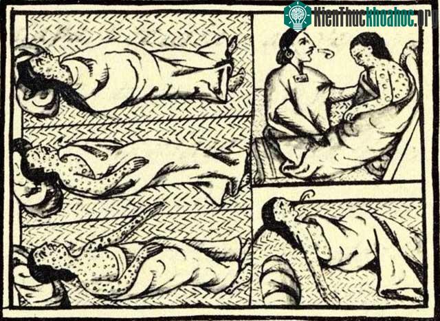 Một bệnh nhân bệnh đậu mùa.