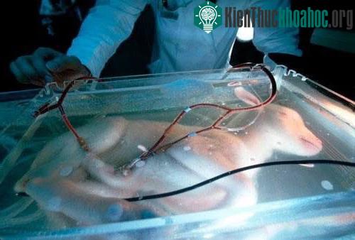 Tử cung nhân tạo: Tương lai phụ nữ không phải "mang nặng đẻ đau" vì đã có máy móc làm thay ảnh 4