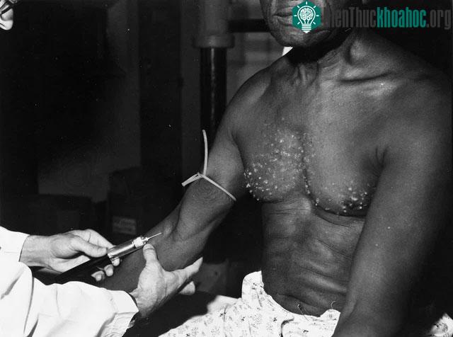 Khi bị phanh phui, chính phủ liên bang đã phải bồi thường cho gia đình bệnh nhân.