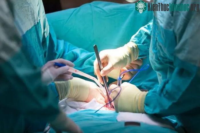 Chuyển đổi nhóm máu giúp cơ quan nội tạng được hiến tặng có thể phù hợp với bất kỳ ai.