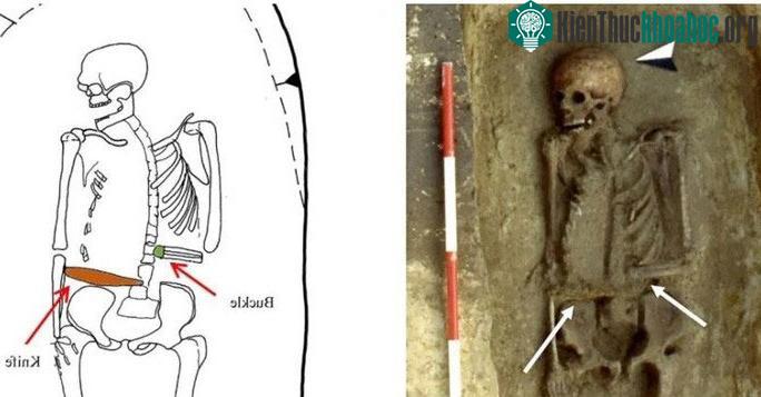 Người đàn ông có tay trái là một con dao