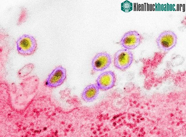 HIV-1 đã được xác định cách đây gần 40 năm.