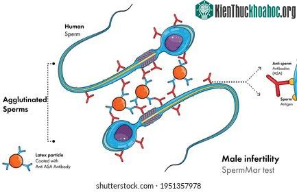 Các kháng thể từ mũi tiêm vây chặt lấy tinh trùng, không cho chúng di chuyển tự do